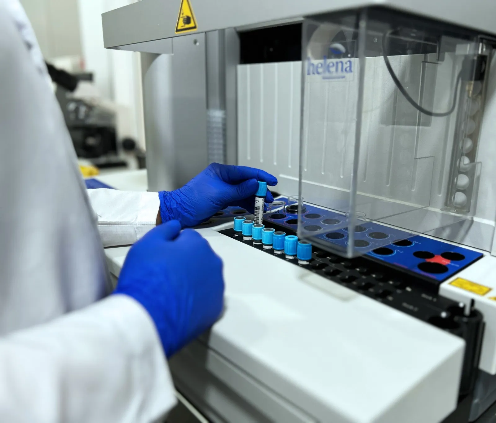 Muestra laboratorio clinico